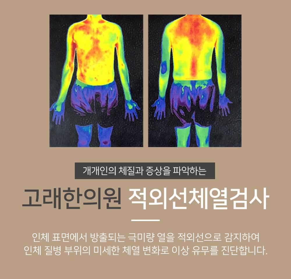 체표 온도 분포를 색으로 나타낸 적외선체열검사 이미지