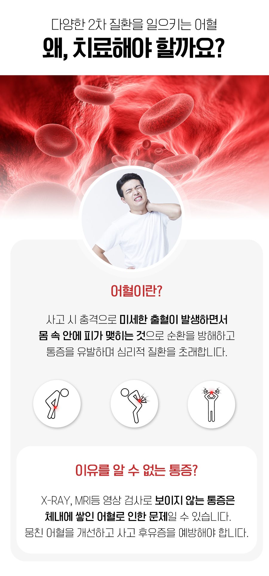 교통사고 충격으로 생기는 어혈을 설명한 이미지